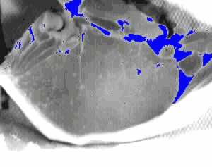 Fatty areas minus the subcutaneous fat region